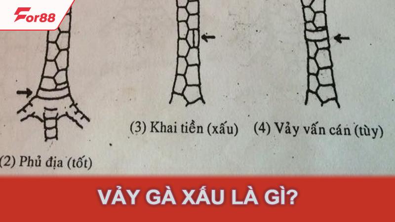 Vảy gà xấu là gì?